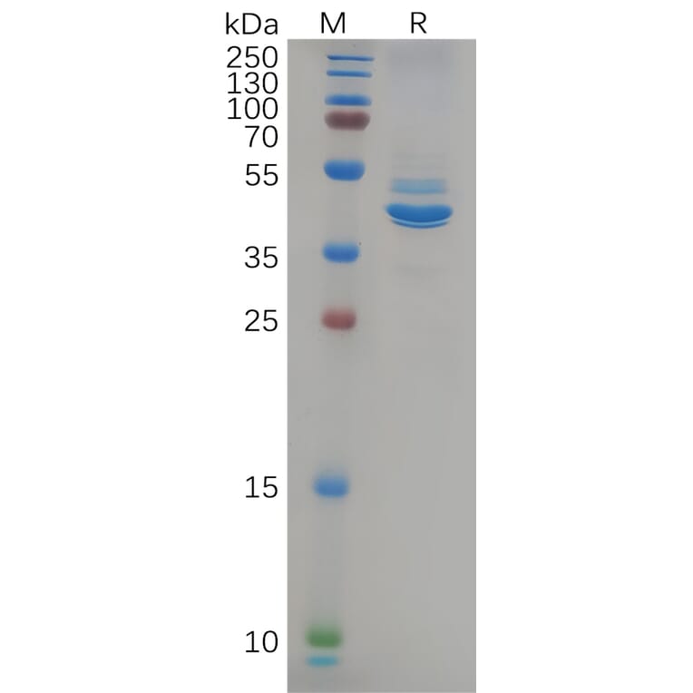 SDS-PAGE - Recombinant Human 68kDa Neurofilament/NF-L Protein (Fc Tag) (A318085) - Antibodies.com