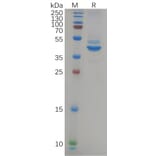 SDS-PAGE - Recombinant Human 68kDa Neurofilament/NF-L Protein (Fc Tag) (A318085) - Antibodies.com