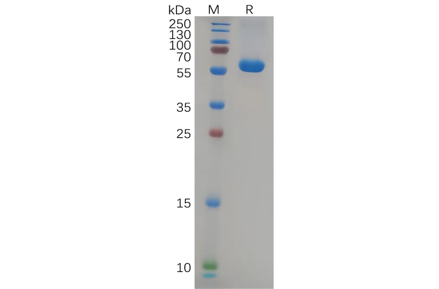 SDS-PAGE - Recombinant SARS-CoV-2 Spike Glycoprotein RBD (Delta B.1.617.2 Variant) (Fc Tag) (A318086) - Antibodies.com