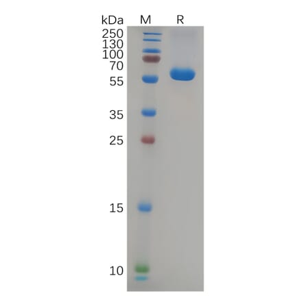 SDS-PAGE - Recombinant SARS-CoV-2 Spike Glycoprotein RBD (Delta B.1.617.2 Variant) (Fc Tag) (A318086) - Antibodies.com