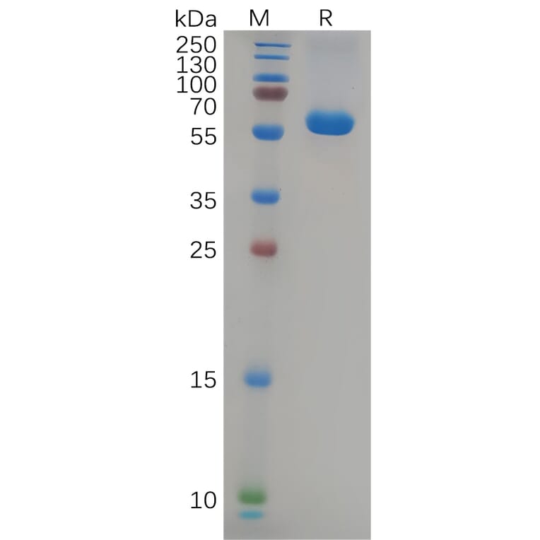SDS-PAGE - Recombinant SARS-CoV-2 Spike Glycoprotein RBD (Delta B.1.617.2 Variant) (Fc Tag) (A318086) - Antibodies.com