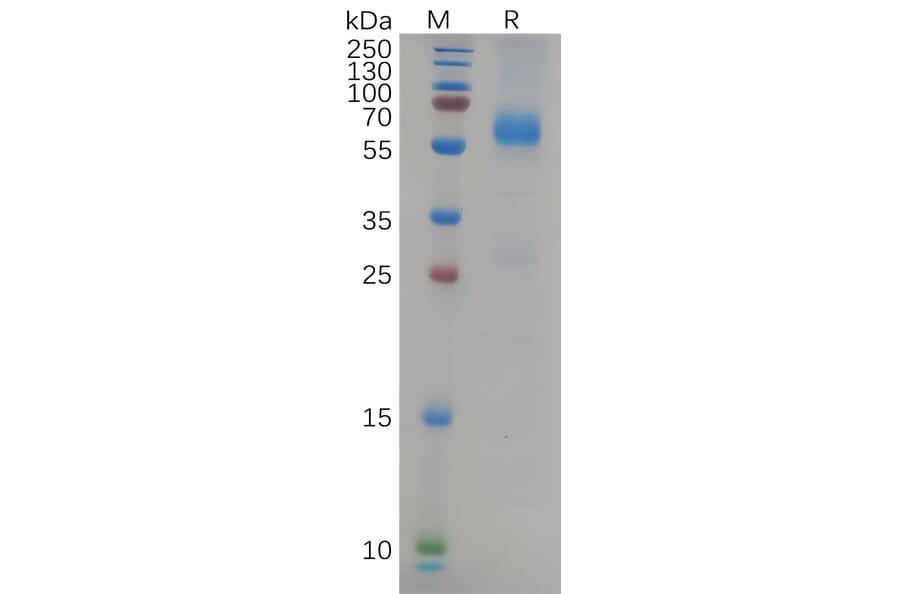 SDS-PAGE - Recombinant SARS-CoV-2 Nucleocapsid Protein (Delta B.1.617.2 Variant) (His Tag) (A318087) - Antibodies.com