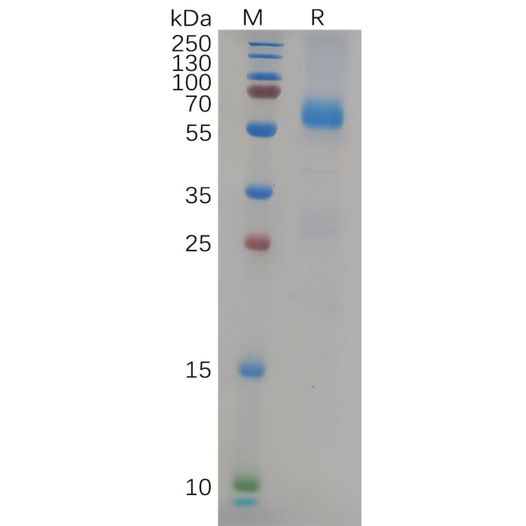 SDS-PAGE - Recombinant SARS-CoV-2 Nucleocapsid Protein (Delta B.1.617.2 Variant) (His Tag) (A318087) - Antibodies.com