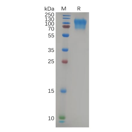 SDS-PAGE - Recombinant Human CD164 Protein (Fc Tag) (A318088) - Antibodies.com