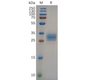 SDS-PAGE - Recombinant Human FOLR2 Protein (6×His Tag) (A318089) - Antibodies.com