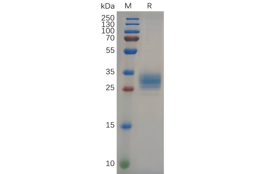 SDS-PAGE - Recombinant Human FOLR2 Protein (6×His Tag) (A318089) - Antibodies.com