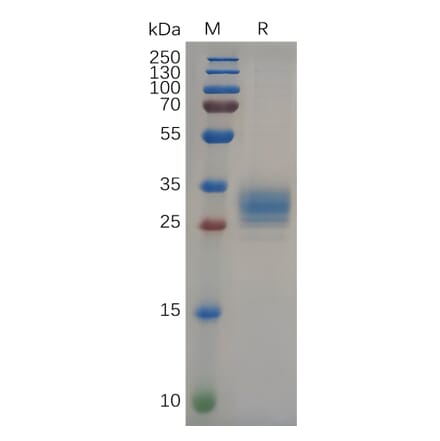 SDS-PAGE - Recombinant Human FOLR2 Protein (6×His Tag) (A318089) - Antibodies.com