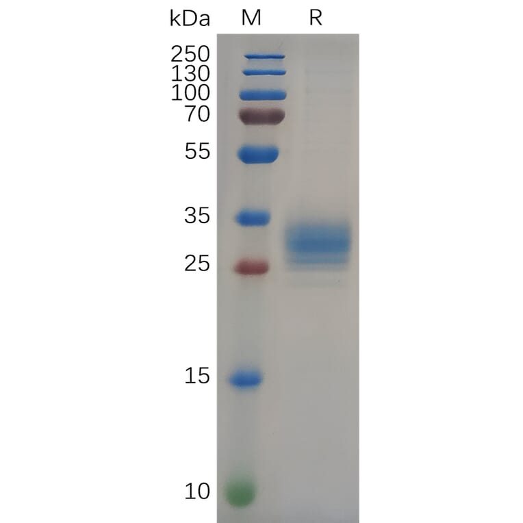 SDS-PAGE - Recombinant Human FOLR2 Protein (6×His Tag) (A318089) - Antibodies.com
