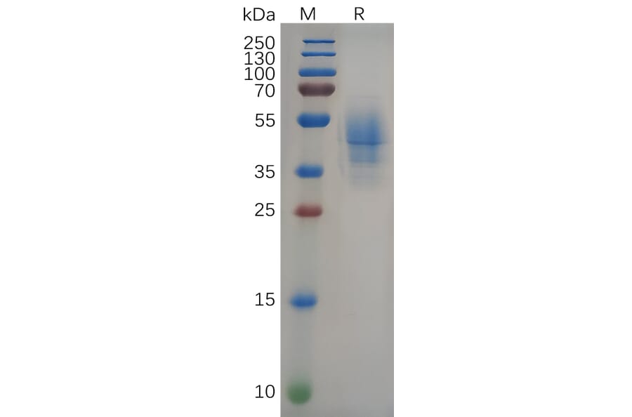 SDS-PAGE - Recombinant Human 68kDa Neurofilament/NF-L Protein (Fc Tag) (A318090) - Antibodies.com