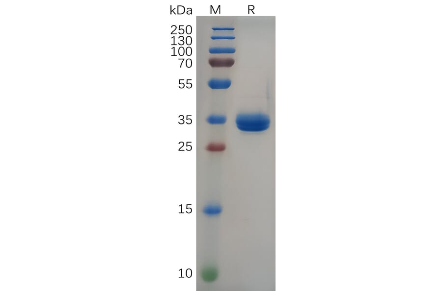 SDS-PAGE - Recombinant Human Gastrin Releasing Peptide Protein (Fc Tag) (A318091) - Antibodies.com