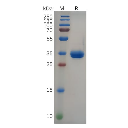 SDS-PAGE - Recombinant Human Gastrin Releasing Peptide Protein (Fc Tag) (A318091) - Antibodies.com