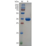 SDS-PAGE - Recombinant Human Gastrin Releasing Peptide Protein (Fc Tag) (A318091) - Antibodies.com