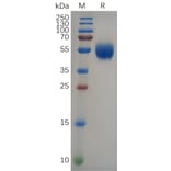 SDS-PAGE - Recombinant Human IL-22 Protein (Fc Tag) (A318092) - Antibodies.com