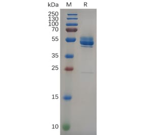 SDS-PAGE - Recombinant Human FZD10 Protein (Fc Tag) (A318093) - Antibodies.com