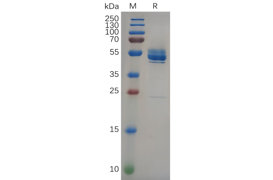 SDS-PAGE - Recombinant Human FZD10 Protein (Fc Tag) (A318093) - Antibodies.com