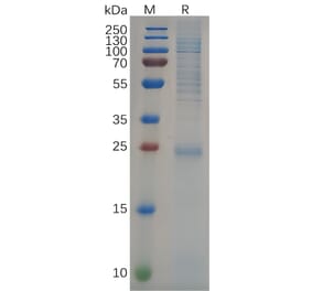 SDS-PAGE - Recombinant Human KRAS Protein (6×His Tag) (A318094) - Antibodies.com