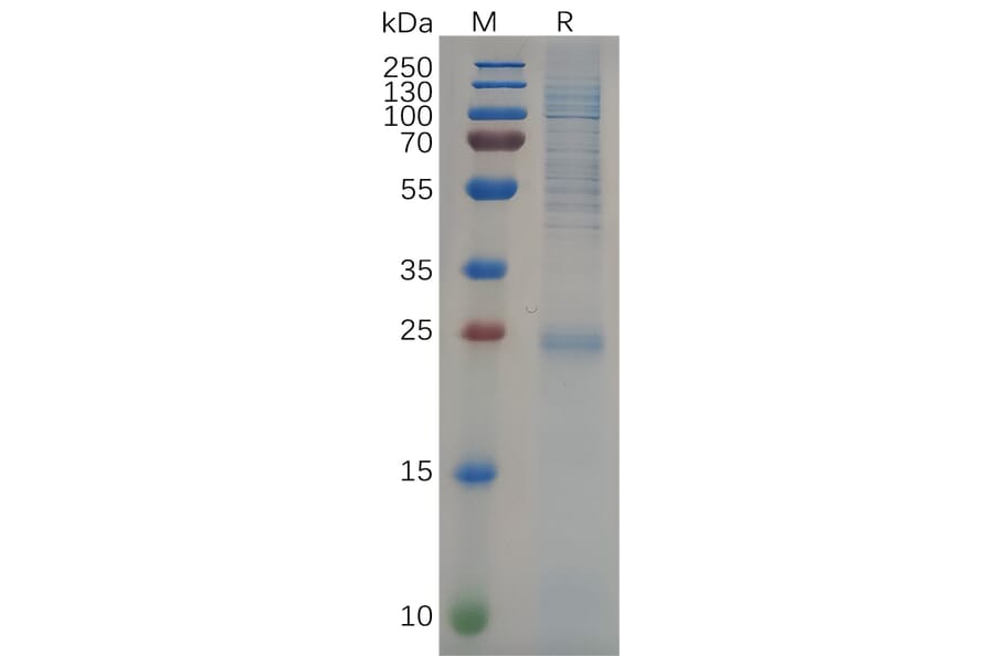 SDS-PAGE - Recombinant Human KRAS Protein (6×His Tag) (A318094) - Antibodies.com