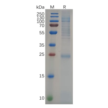 SDS-PAGE - Recombinant Human KRAS Protein (6×His Tag) (A318094) - Antibodies.com