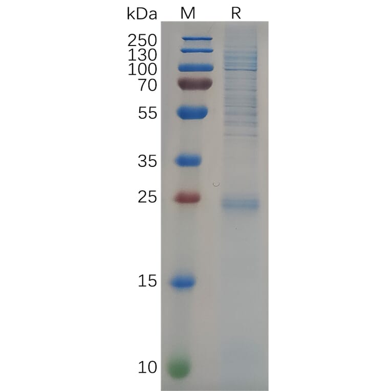 SDS-PAGE - Recombinant Human KRAS Protein (6×His Tag) (A318094) - Antibodies.com