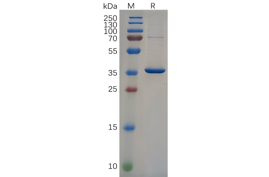 SDS-PAGE - Recombinant Human 68kDa Neurofilament/NF-L Protein (6×His Tag) (A318095) - Antibodies.com