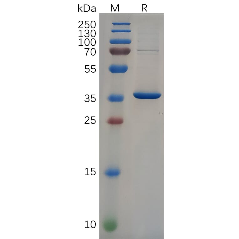 SDS-PAGE - Recombinant Human 68kDa Neurofilament/NF-L Protein (6×His Tag) (A318095) - Antibodies.com