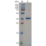 SDS-PAGE - Recombinant Human 68kDa Neurofilament/NF-L Protein (6×His Tag) (A318095) - Antibodies.com