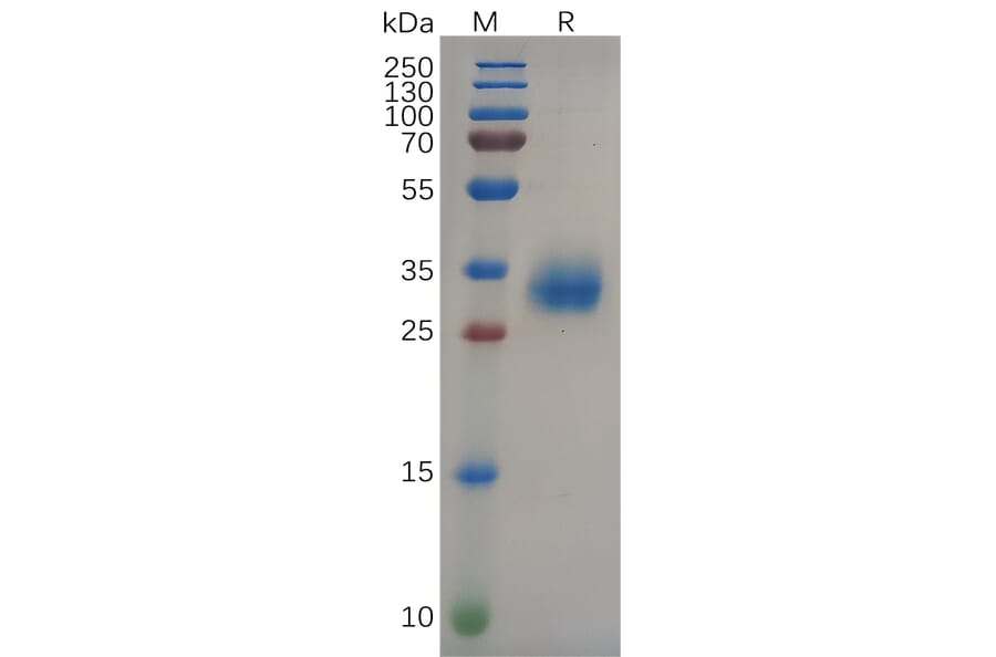 SDS-PAGE - Recombinant SARS-CoV-2 Spike Glycoprotein RBD (Delta B.1.617.2 Variant) (His Tag) (A318096) - Antibodies.com