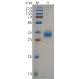 SDS-PAGE - Recombinant SARS-CoV-2 Spike Glycoprotein RBD (Delta B.1.617.2 Variant) (His Tag) (A318096) - Antibodies.com