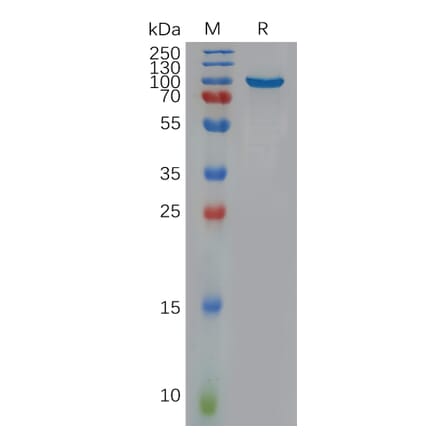 SDS-PAGE - Recombinant Human NOTCH3 Protein (Fc Tag) (A318097) - Antibodies.com