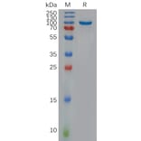 SDS-PAGE - Recombinant Human NOTCH3 Protein (Fc Tag) (A318097) - Antibodies.com