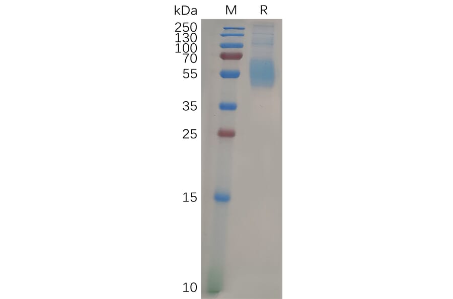 SDS-PAGE - Recombinant Human Siglec 7 Protein (6×His Tag) (A318098) - Antibodies.com