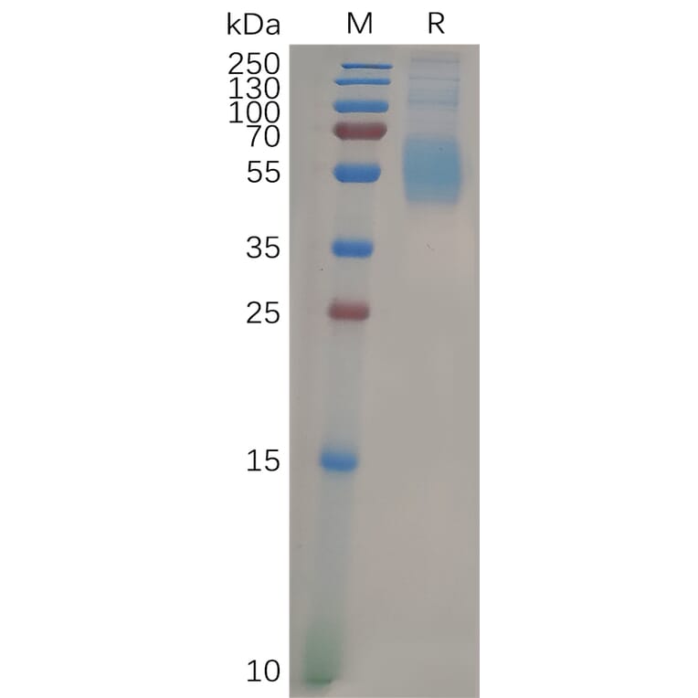 SDS-PAGE - Recombinant Human Siglec 7 Protein (6×His Tag) (A318098) - Antibodies.com