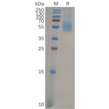 SDS-PAGE - Recombinant Human Siglec 7 Protein (6×His Tag) (A318098) - Antibodies.com