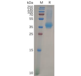 SDS-PAGE - Recombinant Human CD23 Protein (6×His Tag) (A318099) - Antibodies.com