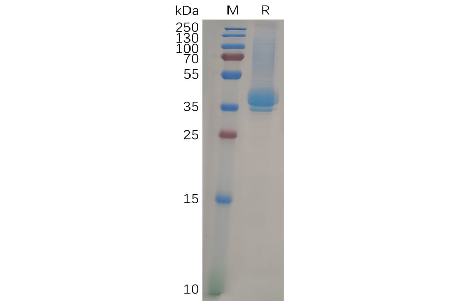 SDS-PAGE - Recombinant Human CD23 Protein (6×His Tag) (A318099) - Antibodies.com