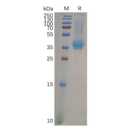 SDS-PAGE - Recombinant Human CD23 Protein (6×His Tag) (A318099) - Antibodies.com