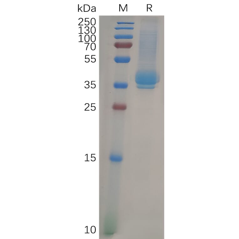 SDS-PAGE - Recombinant Human CD23 Protein (6×His Tag) (A318099) - Antibodies.com