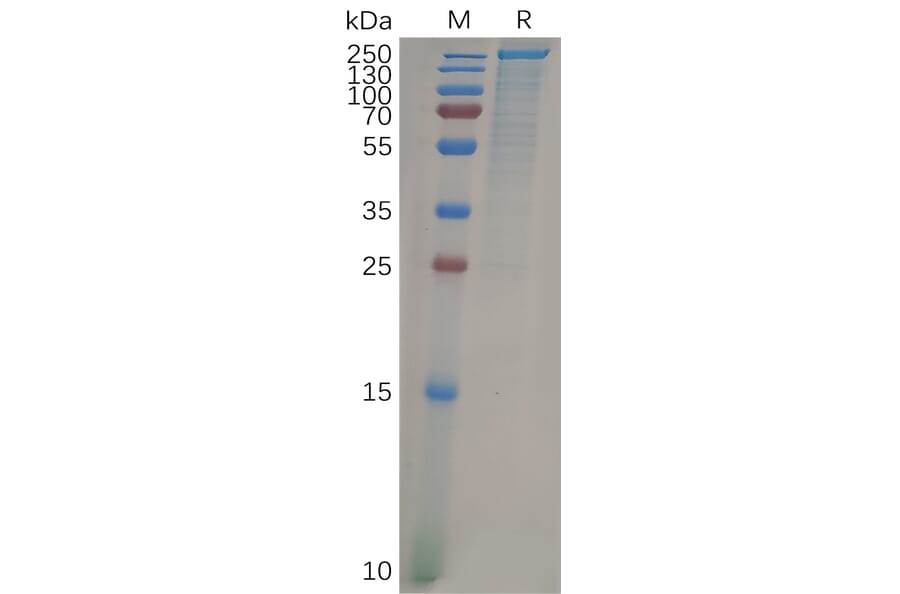 SDS-PAGE - Recombinant Human LY75/DEC-205 Protein (6×His Tag) (A318100) - Antibodies.com