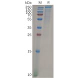 SDS-PAGE - Recombinant Human LY75/DEC-205 Protein (6×His Tag) (A318100) - Antibodies.com