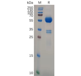 SDS-PAGE - Recombinant Human CD74 Protein (Fc Tag) (A318101) - Antibodies.com