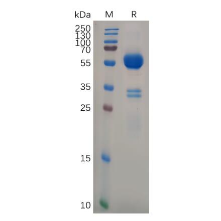 SDS-PAGE - Recombinant Human CD74 Protein (Fc Tag) (A318101) - Antibodies.com