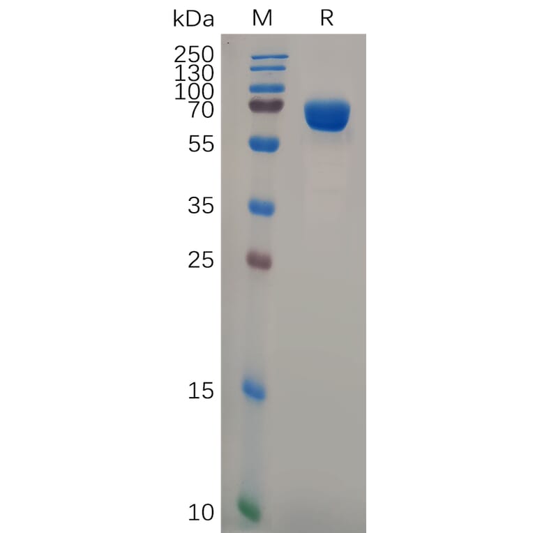 SDS-PAGE - Recombinant Human Bone Marrow Stromal Cell Antigen 1 Protein (Fc Tag) (A318102) - Antibodies.com