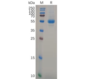 SDS-PAGE - Recombinant Human IL-11 Protein (Fc Tag) (A318103) - Antibodies.com