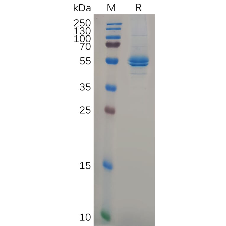 SDS-PAGE - Recombinant Human IL-11 Protein (Fc Tag) (A318103) - Antibodies.com