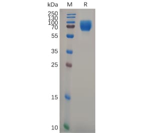SDS-PAGE - Recombinant Human Growth Hormone Receptor Protein (Fc Tag) (A318104) - Antibodies.com