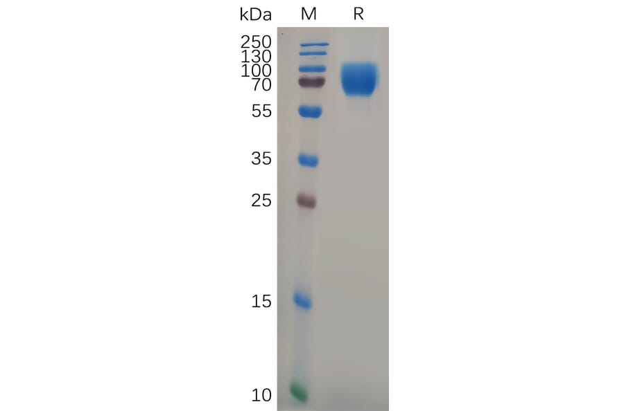 SDS-PAGE - Recombinant Human Growth Hormone Receptor Protein (Fc Tag) (A318104) - Antibodies.com