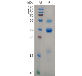 SDS-PAGE - Recombinant Human TSLP Protein (Fc Tag) (A318105) - Antibodies.com