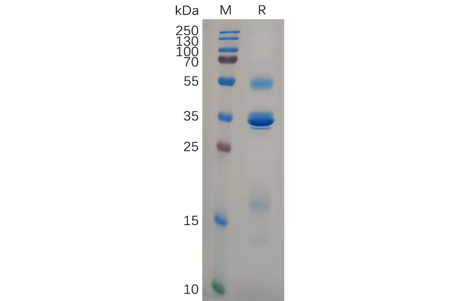 SDS-PAGE - Recombinant Human TSLP Protein (Fc Tag) (A318105) - Antibodies.com