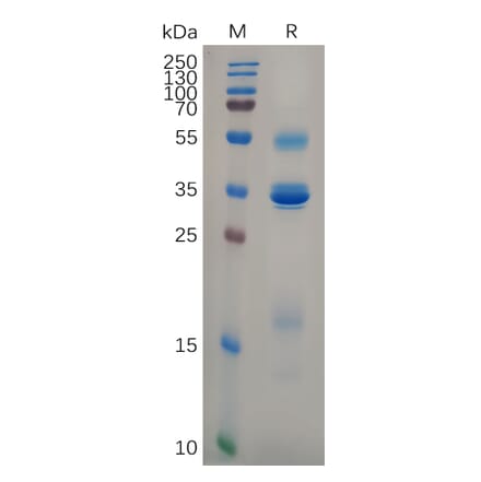 SDS-PAGE - Recombinant Human TSLP Protein (Fc Tag) (A318105) - Antibodies.com