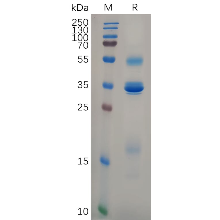 SDS-PAGE - Recombinant Human TSLP Protein (Fc Tag) (A318105) - Antibodies.com